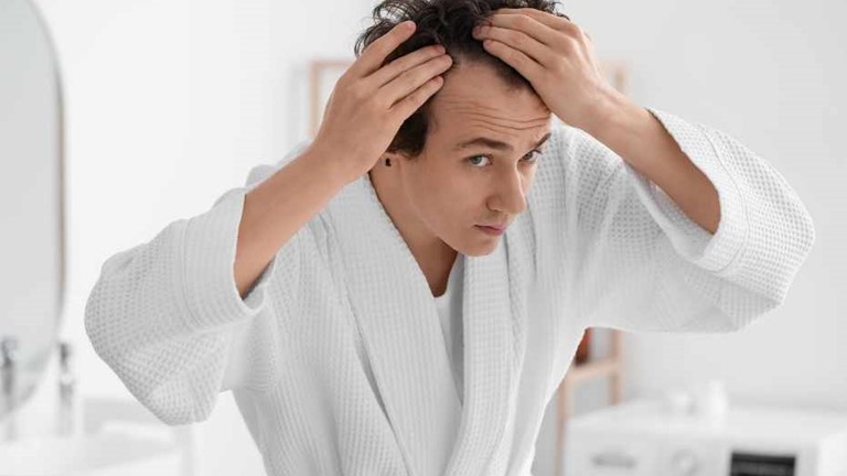 Tackling men's hair loss: modern solutions for a confident look