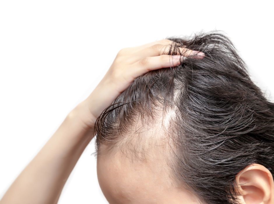 Best haircuts for men with receding hairline