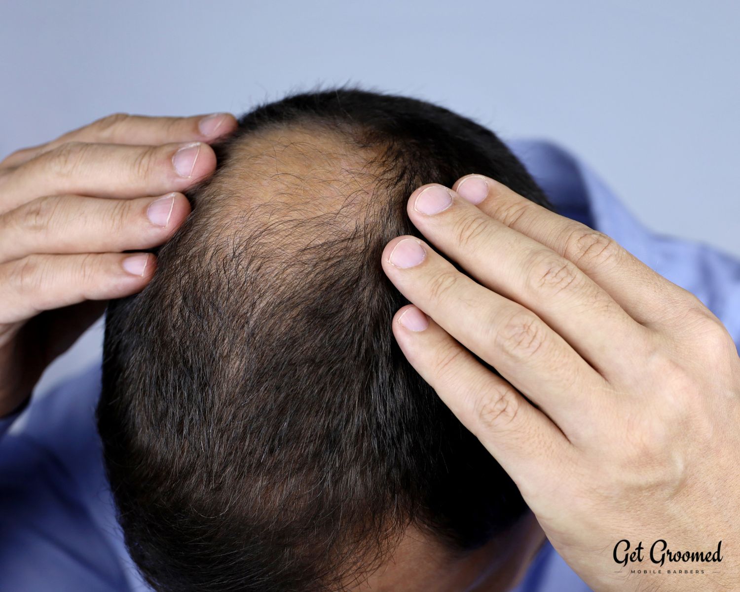What Causes Hair Loss in Men (And What You Can Do About It)