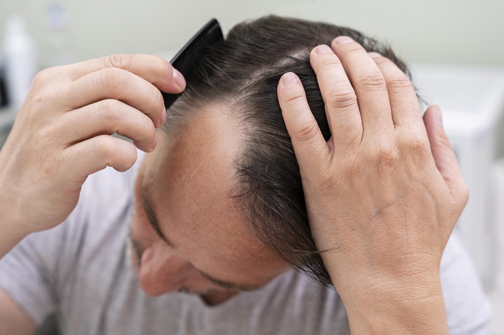 Superfoods to eat to reduce hair loss